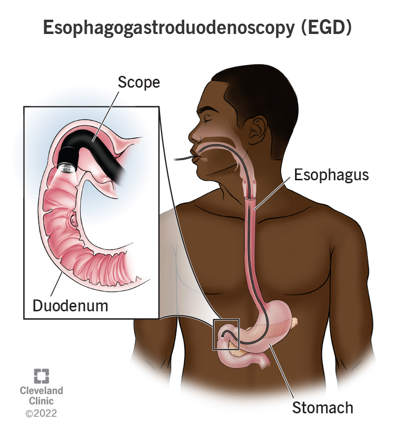 Gastroentérologie