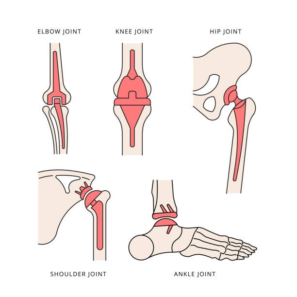 Orthopaedics